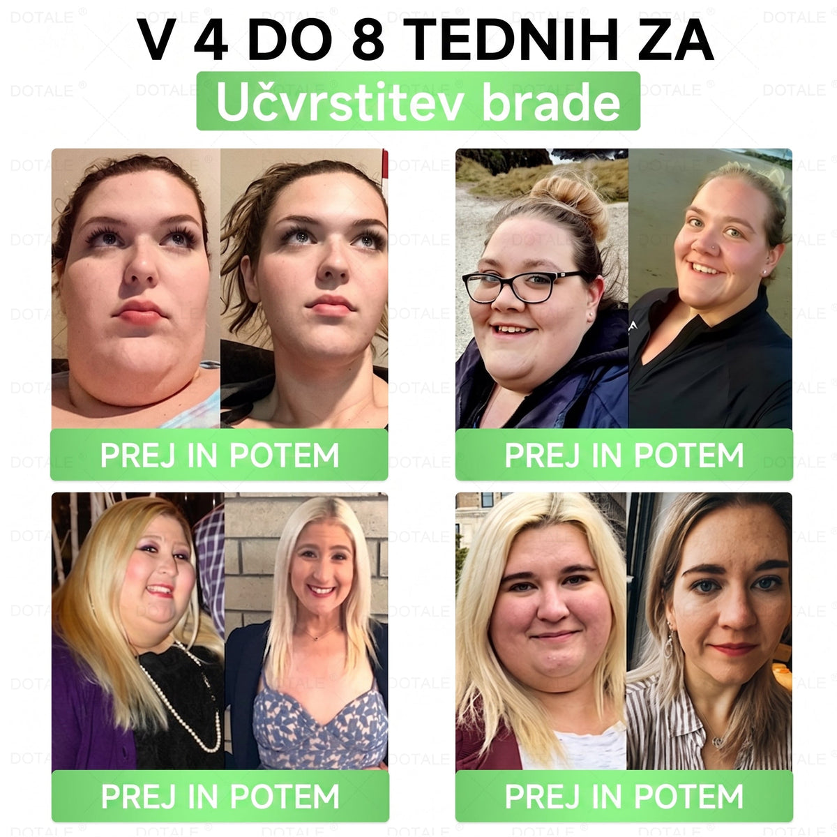 𝑫𝑶𝑻𝑨𝑳𝑬® Presnovni nanomikroiglični obliž (Samo enkrat na dan, vidne spremembe v 7 dneh)